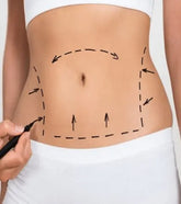 Radio Frequency Body Tightening Caring