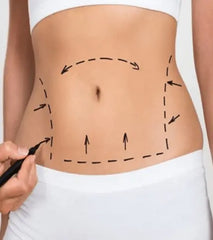 Radio Frequency Body Tightening Caring