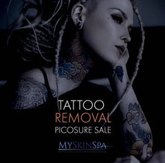 Tattoo Removal Pico Laser