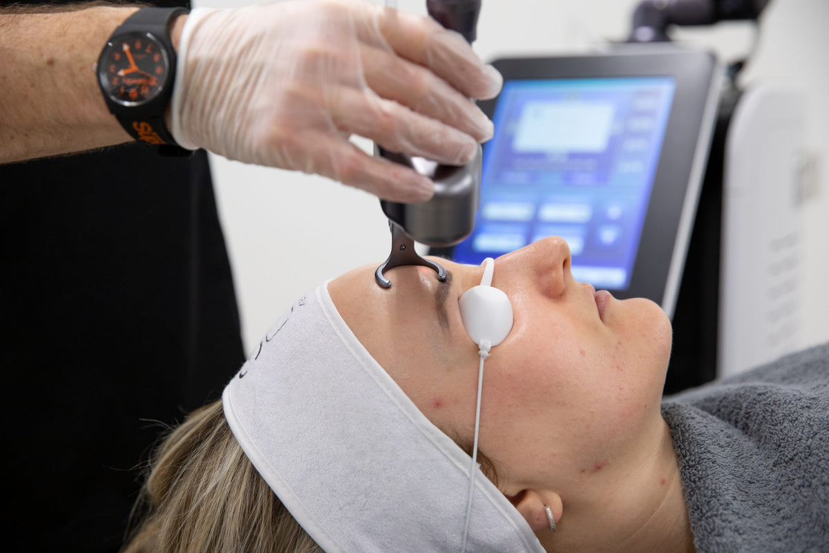 Pigmentation Removal