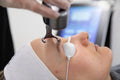 Co2 Laser Skin Rejuvenation