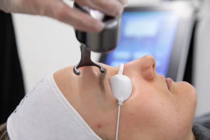 Co2 Laser Skin Rejuvenation