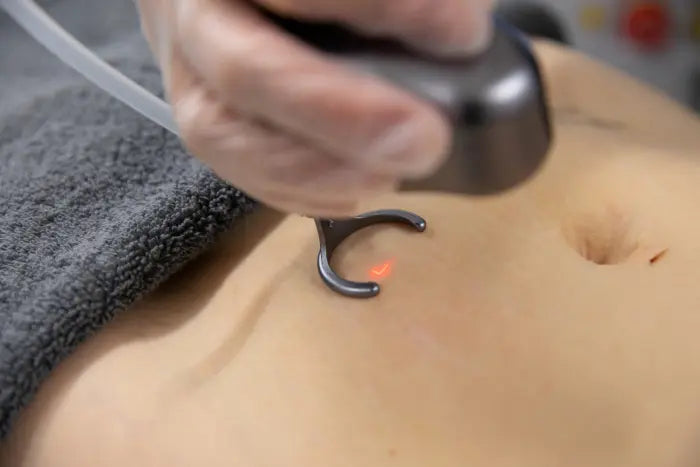 Co2 Laser Skin Rejuvenation