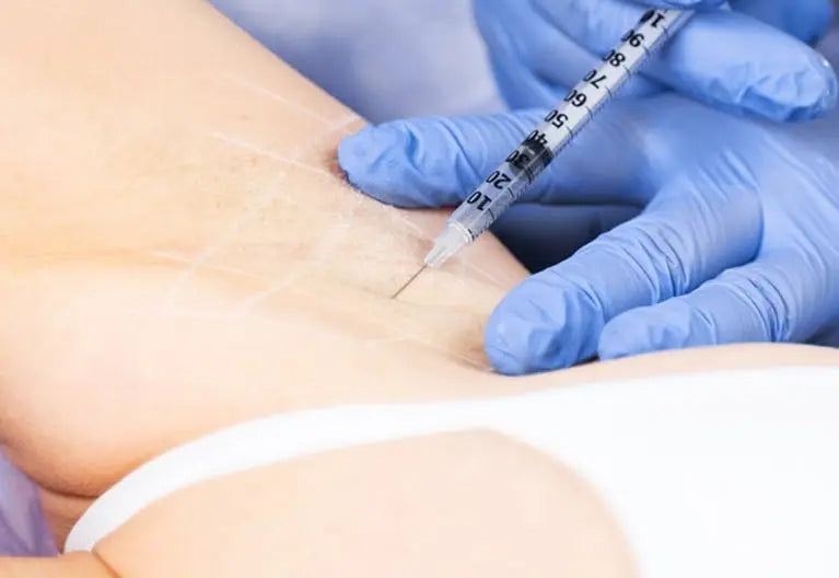Anti Wrinkle Treatment