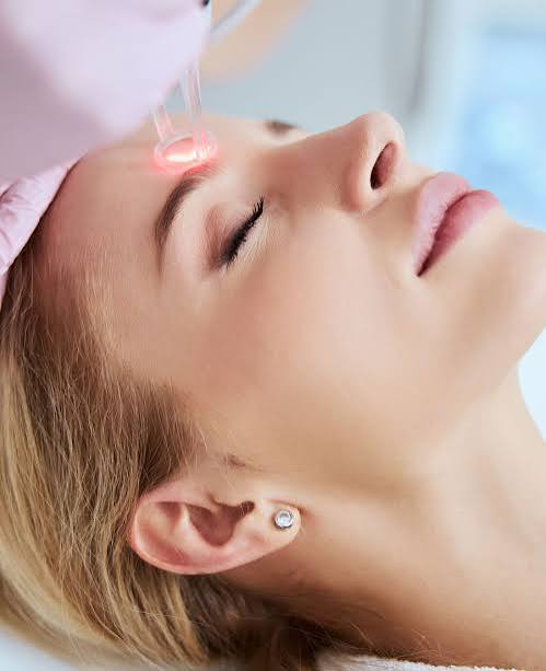Co2 Laser Skin Rejuvenation