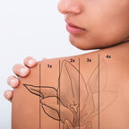 Tattoo Removal Pico Laser