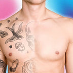 Tattoo Removal Pico Laser