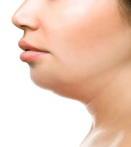 Double Chin Reduction