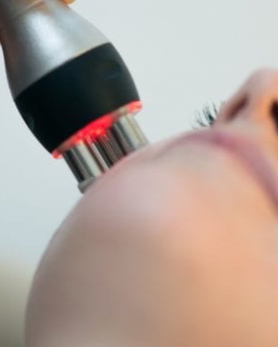 3d lipo Radiofrequency Skin Tightening