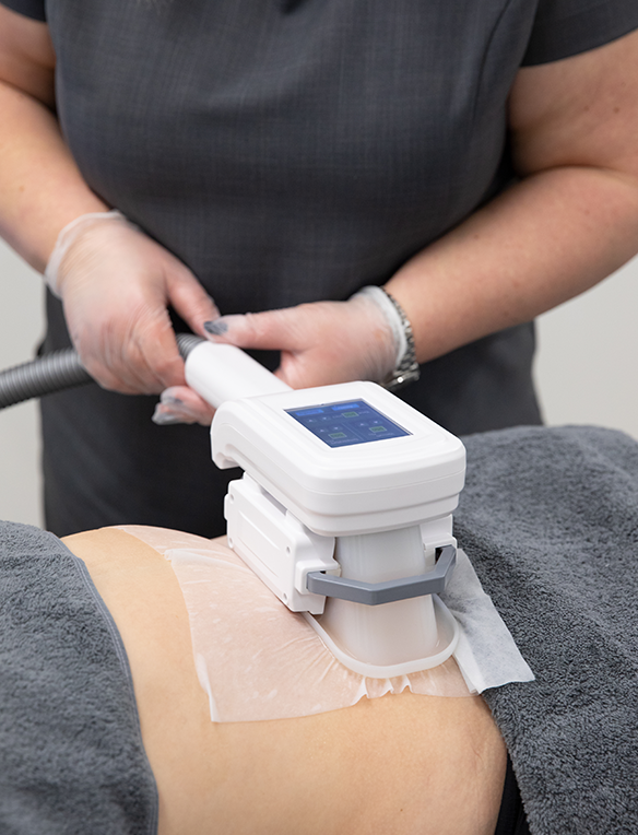 3D Lipo Cryolipolysis (Fat Freeze)