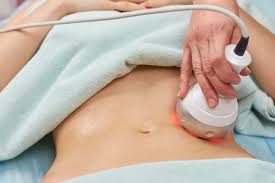 Body HIFU Treatment