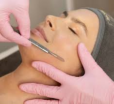 DermaPlaning Treatment