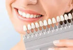 Laser Teeth Whitening Sessions