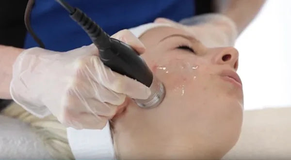 3d lipo Radiofrequency Skin Tightening