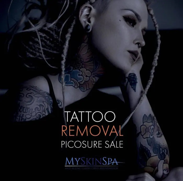 Tattoo Removal Pico Laser