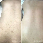 The Original GREEN PEEL® Herbal Peeling
