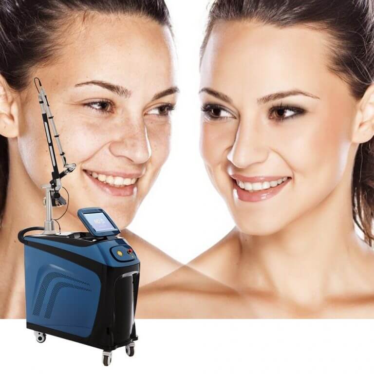 Laser Tattoo Removal My Skin Spa Laser Tattoo Removal My Skin Spa