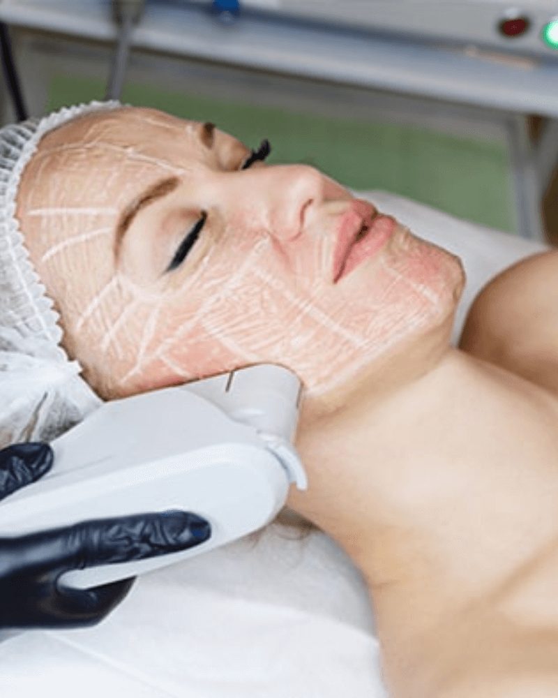 HIFU Non-Surgical Facelift My Skin Spa