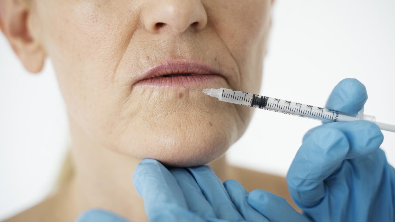 Profhilo vs Dermal Fillers